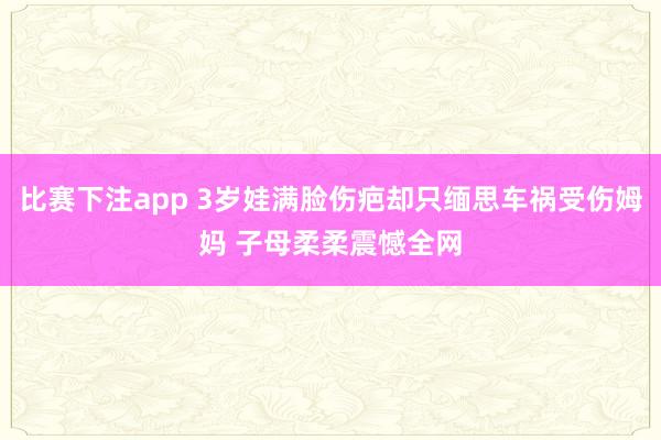 比赛下注app 3岁娃满脸伤疤却只缅思车祸受伤姆妈 子母柔柔震憾全网