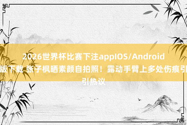 2026世界杯比赛下注appIOS/Android手机版下载 张子枫晒素颜自拍照！露动手臂上多处伤痕引热议