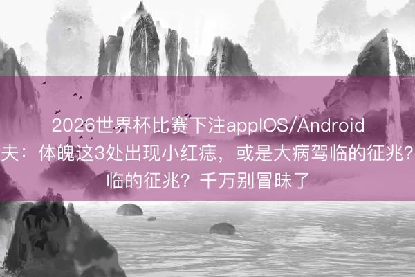 2026世界杯比赛下注appIOS/Android手机版下载 大夫：体魄这3处出现小红痣，或是大病驾临的征兆？千万别冒昧了